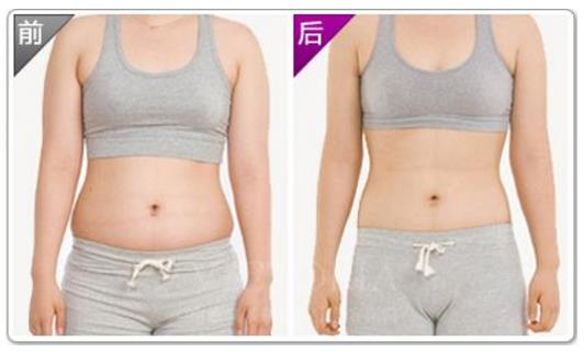 埋線減肥 中醫埋線就能想瘦就瘦?獨特減肥方法