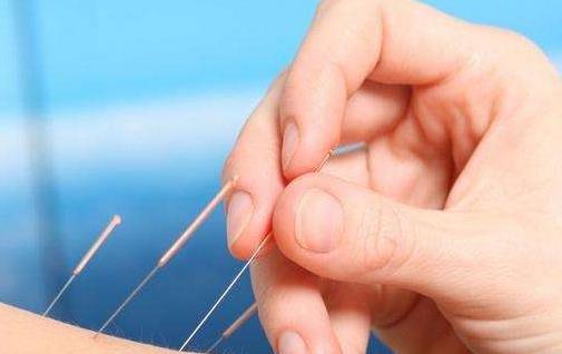 針灸減肥 針灸為什么能減掉脂肪?針灸減脂的原理