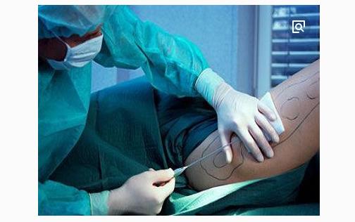 醫學減肥與藥物減肥有哪些區別