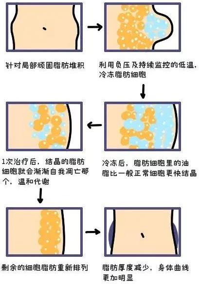 武漢藝星整形醫(yī)院:6月22-28日酷塑減脂專場,讓你輕輕松松的減肥!