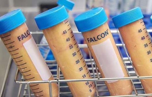 抽脂安全嗎?抽脂后有哪些后遺癥?