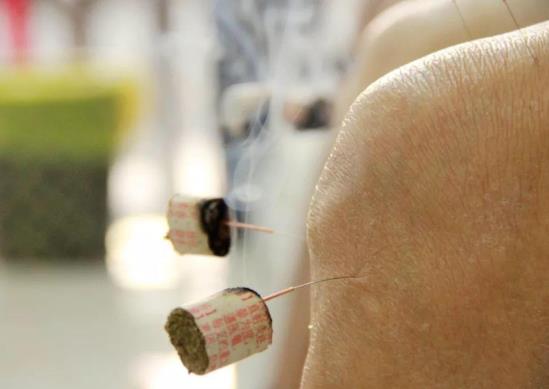 針灸減肥要堅(jiān)持多久才行?針灸減肥幾次一個療程?