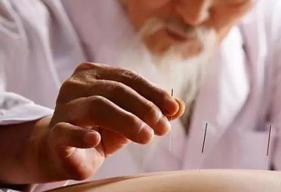 經(jīng)期可以針灸減肥嗎?針灸減肥會影響例假嗎?