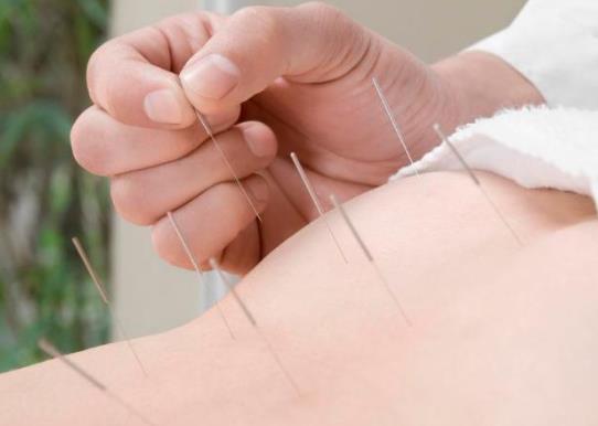 針灸減肥要扎哪些部位?針灸減肥想減20斤需要做多久?