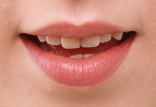 嘴唇干裂是什么原因?嘴唇干裂怎么辦?