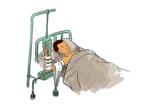 骨折病人吃什么好?骨折愈合的時間