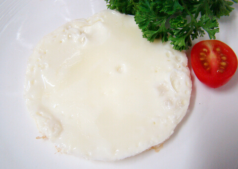 某種蛋白質(zhì)可以改善腦白質(zhì)損傷