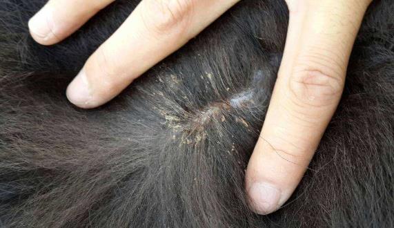 頭上長虱子怎么辦?虱子怎么去除?去虱子和虱子卵的有效方法