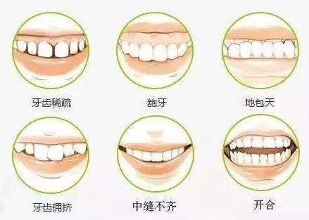 貴陽(yáng)牙齒矯正哪家好,牙齒稀疏可以做矯正嗎?