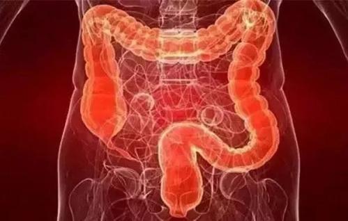 長痔瘡怎么辦?痔瘡膏什么好