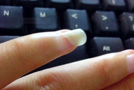 指甲上的月牙是什么?細數指甲出現的各種癥狀