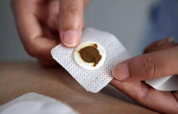 三伏貼是當(dāng)天忌口還是整個(gè)三伏天里都忌口?貼三伏貼要忌口什么