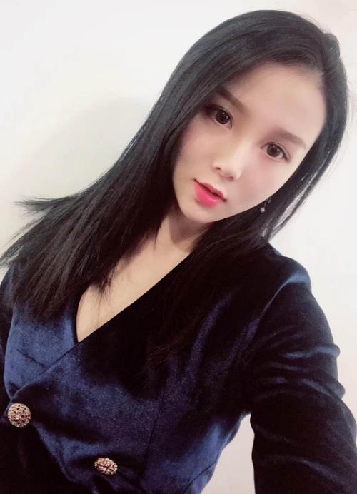 慈溪悅爾整形門診部做桃迷眼雙眼皮太好看了吧