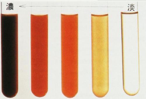 尿血的癥狀及引起尿血的疾病有哪些?