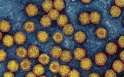 紅斑狼瘡會引起哪些病變?紅斑狼瘡能治好嗎?紅斑狼瘡有哪些治療方式?