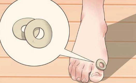 患了雞眼怎么辦?雞眼怎么治療?