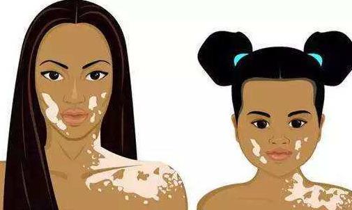 患白癜風的病因有哪些?怎么預防白癜風?