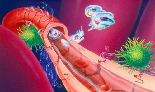 患毒血癥的病因有哪些?患毒血癥有哪些并發癥?