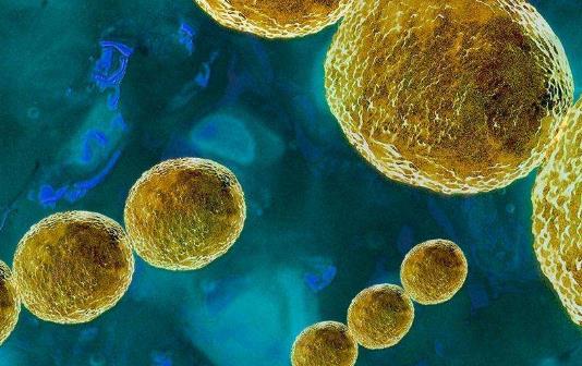 引起附睪炎的原因有哪些?患附睪炎有哪些危害?