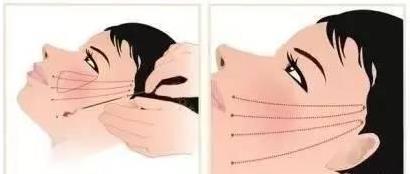 中家醫整形23周年慶帶你了解做線雕6大優勢和效果!