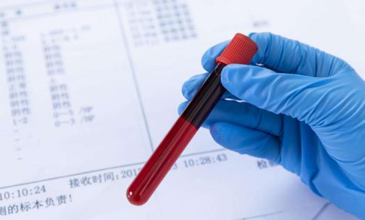 痛經(jīng)可以做哪些檢查?痛經(jīng)的治療方法有哪些?