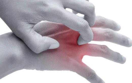 蕁麻疹怎么樣治療?蕁麻疹常見類型有哪些?