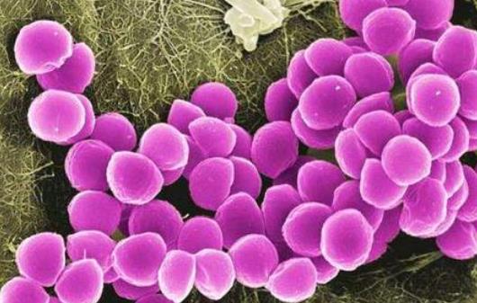 患頭皮癬有哪些危害?頭皮癬有哪些癥狀分類?