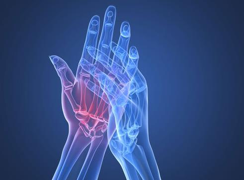 類風(fēng)濕性關(guān)節(jié)炎需要注意什么?類風(fēng)濕性關(guān)節(jié)炎的癥狀