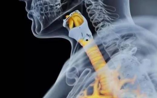 什么是喘息樣支氣管炎?喘息性支氣管炎有哪些危害?