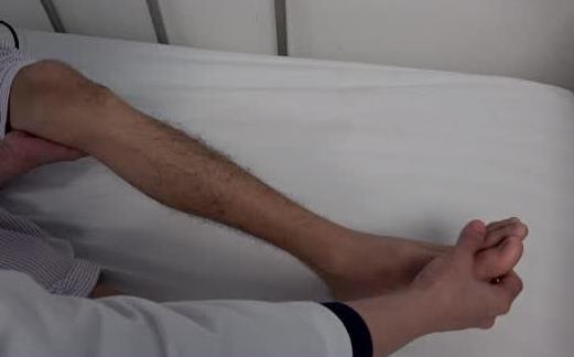 什么是踝陣攣?患踝陣攣的原因有哪些?