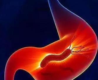 胃竇炎嚴重嗎?胃竇炎吃什么食物好