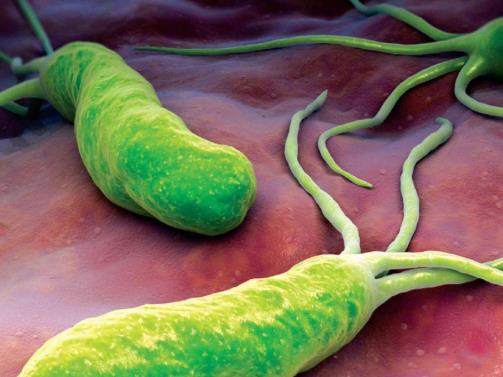 什么是幽門螺旋桿菌?幽門螺旋桿菌會癌變嗎?