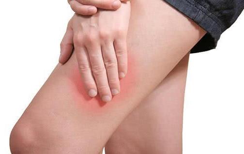 腿疼掛什么科?更年期腿疼是怎么回事