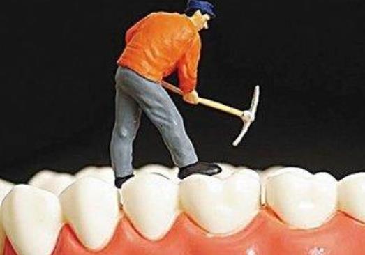 牙結石可以自己扣掉嗎?牙結石怎么才可除去?