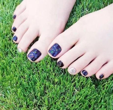 腳底疣不痛不癢還要治療嗎?腳底疣會傳染到手上嗎?