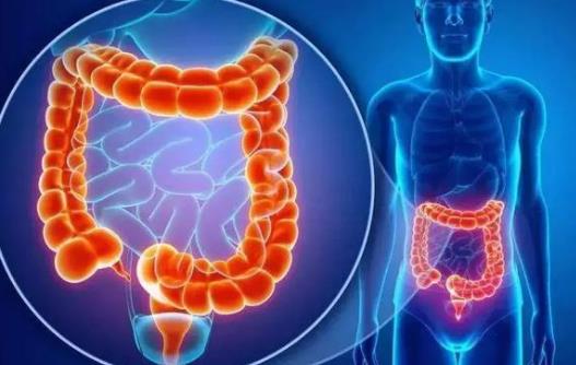 怎么可以檢查除直腸息肉?怎么預防直腸息肉?