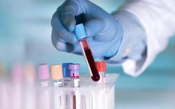 為什么抽血檢查需要空腹?一般需要空腹多久?