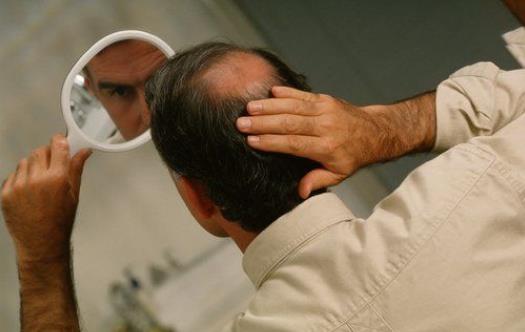 醋可以洗頭嗎?用醋洗頭有哪些好處?