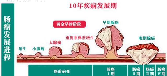 西安東大肛腸醫(yī)院:惋惜,那些被腸癌奪走的生命