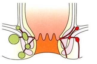 春夏之交肛瘺易爆發(fā) 西安東大肛腸醫(yī)院支招讓你避煩惱