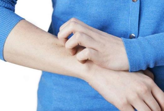 得股蘚了可以運動嗎?得股蘚了要注意什么