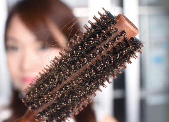 女生脫發吃什么?如何預防脫發