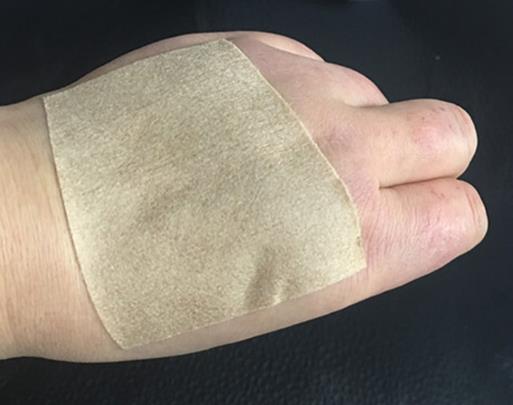 貼完膏藥皮膚變硬皺怎么辦?三伏貼可以用膏藥代替嗎?