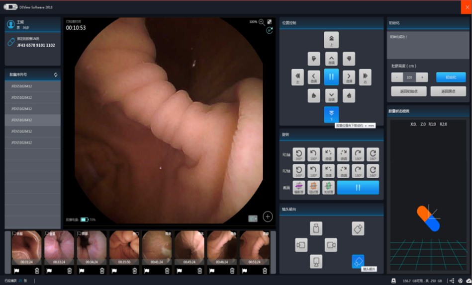 鄭州豐益肛腸醫(yī)院:吞服一粒小膠囊就可以?這樣的胃鏡你愿意做嗎?