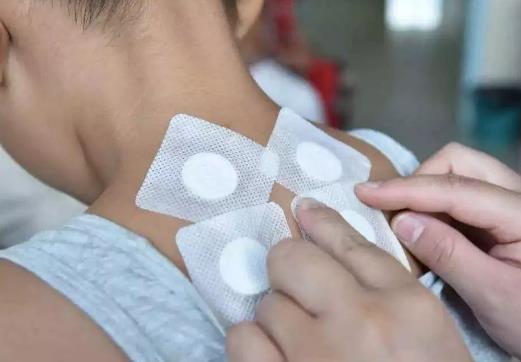 三伏貼最后一貼什么時(shí)候貼?三伏貼是隔天貼還是連續(xù)貼