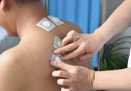 三伏貼最后一貼可以晚點貼嗎?三伏貼7天貼一次中間多貼二次可以嗎