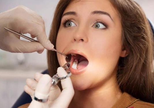 拔牙后怎么刷牙?拔牙后刷牙要注意什么事項