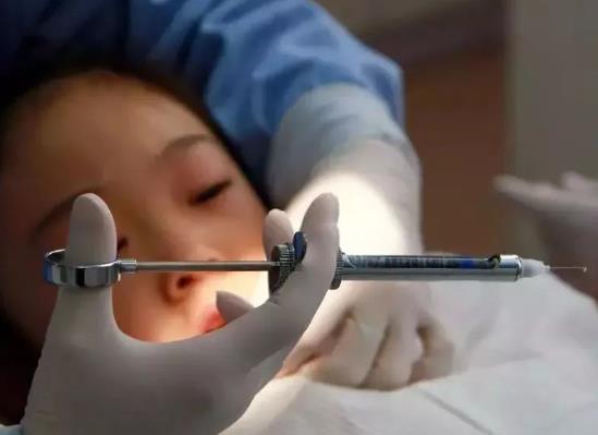 拔牙只能一顆一顆拔嗎?拔牙可以一次性拔四顆智齒嗎