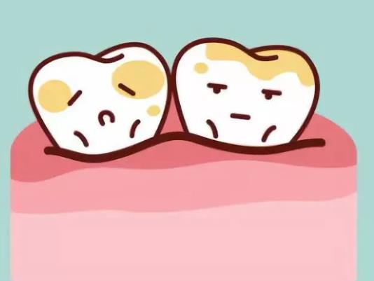 牙結(jié)石是如何形成的?牙結(jié)石可以有多大