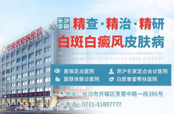 長沙華研皮膚病醫院好嗎